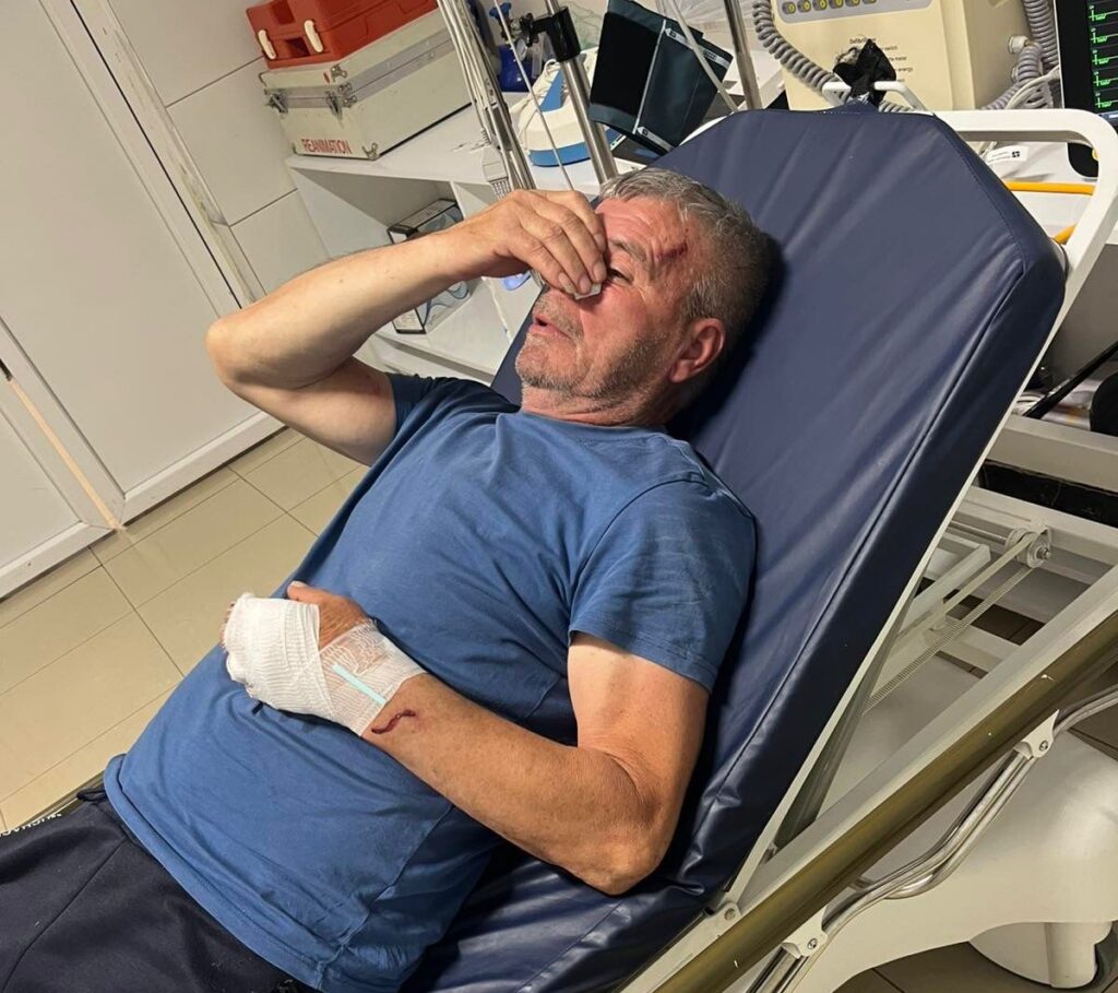 Србин претучен у Биначу од стране локалног Албанца, полиција истражује случај