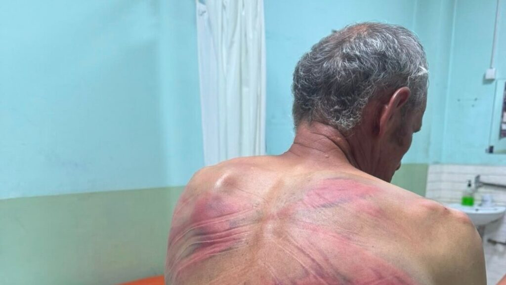 Зубин Поток: Албански полицајци се иживљавали над Србином, тражили да призна “ратни злочин”